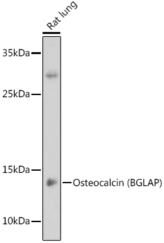 BGLAP Rabbit Polyclonal Antibody