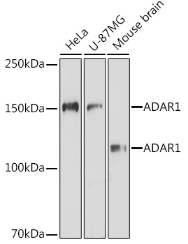 ADAR Rabbit Polyclonal Antibody