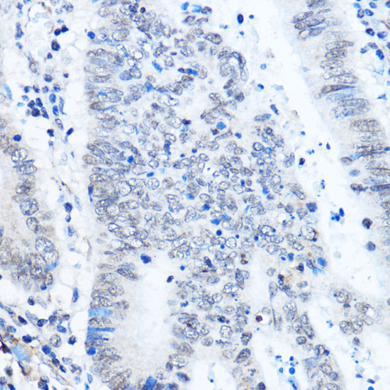 ADAR Rabbit Polyclonal Antibody