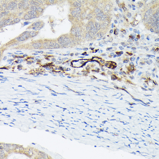 VWF Rabbit Polyclonal Antibodiy