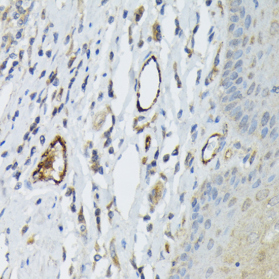 VWF Rabbit Polyclonal Antibodiy
