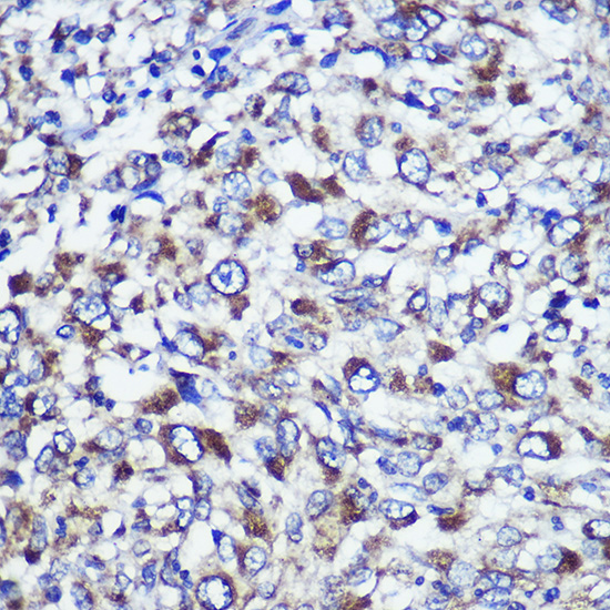 DIS3L Polyclonal Antibody