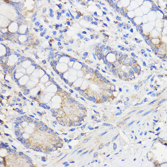 WBSCR27 Polyclonal Antibody