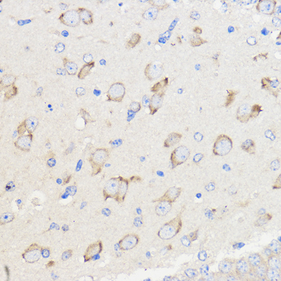 WBSCR27 Polyclonal Antibody