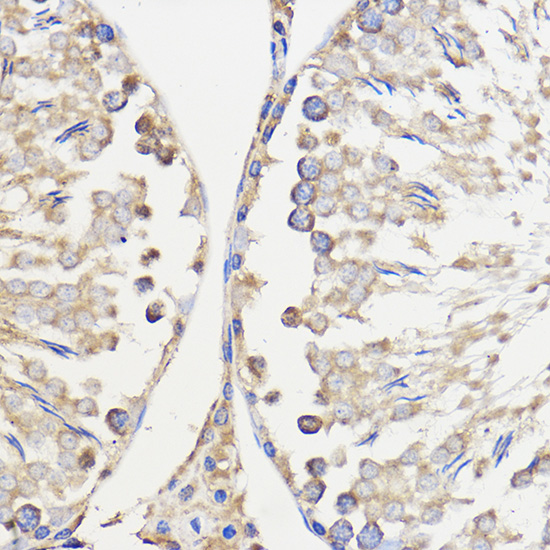 WBSCR27 Polyclonal Antibody