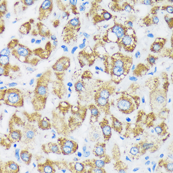 GTPBP8 Polyclonal Antibody