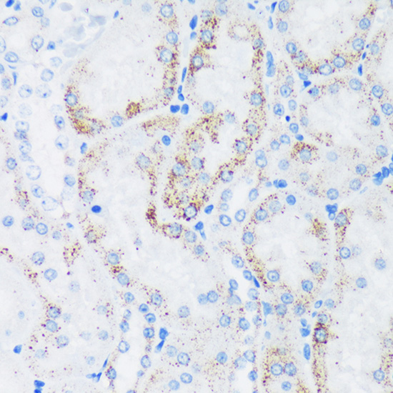 GTPBP8 Polyclonal Antibody