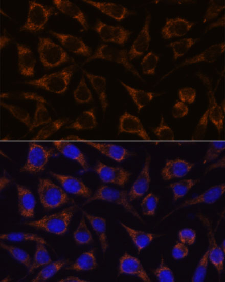 GTPBP8 Polyclonal Antibody