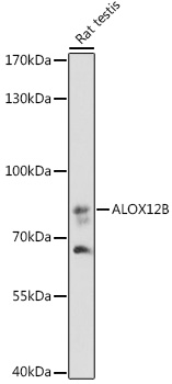 ALOX12B Polyclonal Antibody