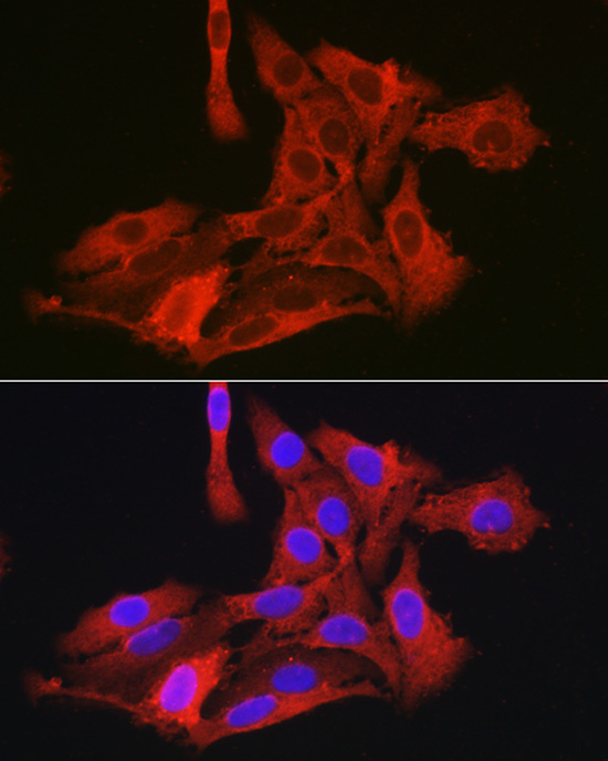G6PC3 Polyclonal Antibody