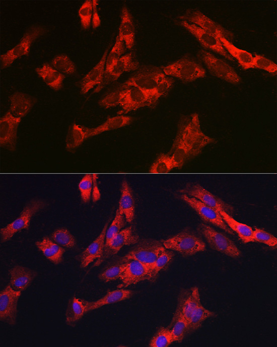 G6PC3 Polyclonal Antibody