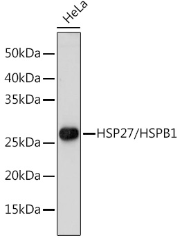 HSPB1 Polyclonal Antibody
