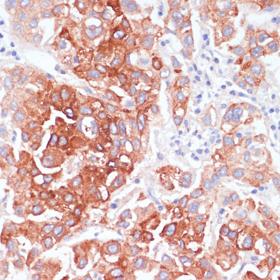 AKT1 Polyclonal Antibody