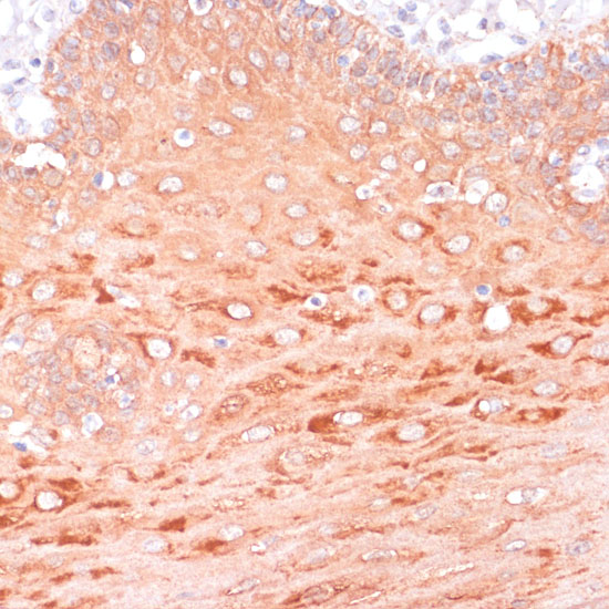 AKT1 Polyclonal Antibody