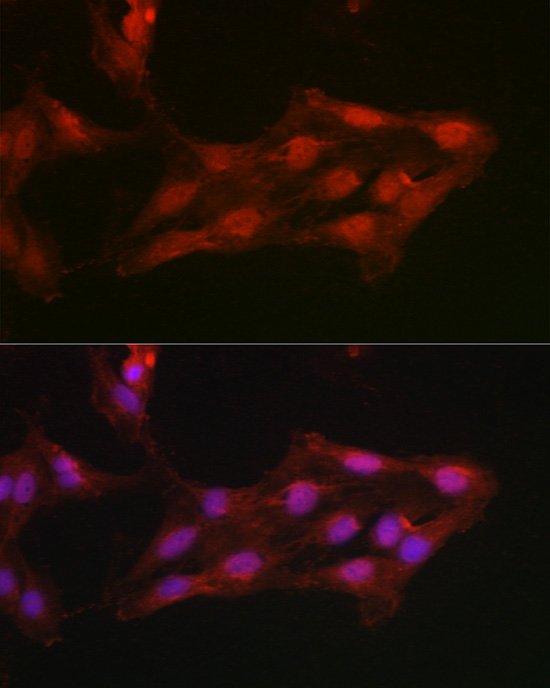 AKT1 Polyclonal Antibody