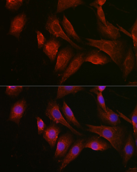 AKT1 Polyclonal Antibody