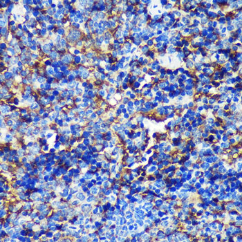 CAND2 Polyclonal Antibody