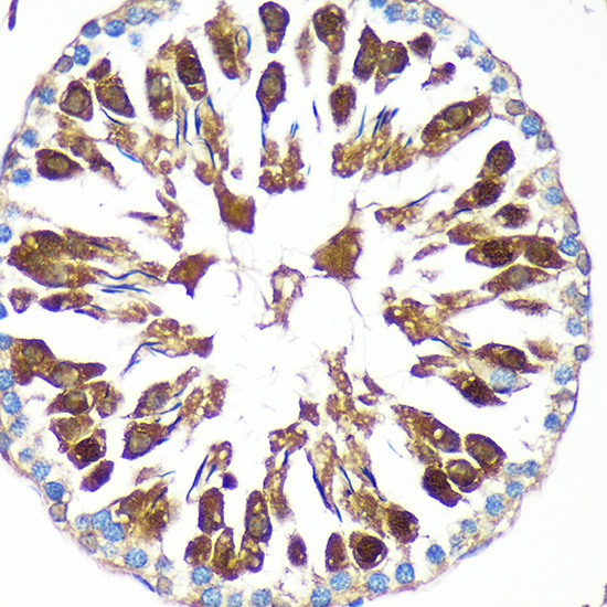 CAND2 Polyclonal Antibody