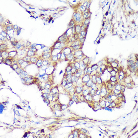 CAND2 Polyclonal Antibody