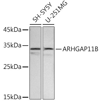 ARHGAP11B Polyclonal Antibody