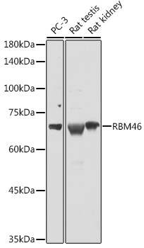 RBM46 Polyclonal Antibody