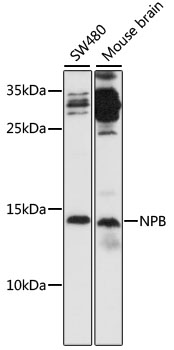NPB Polyclonal Antibody