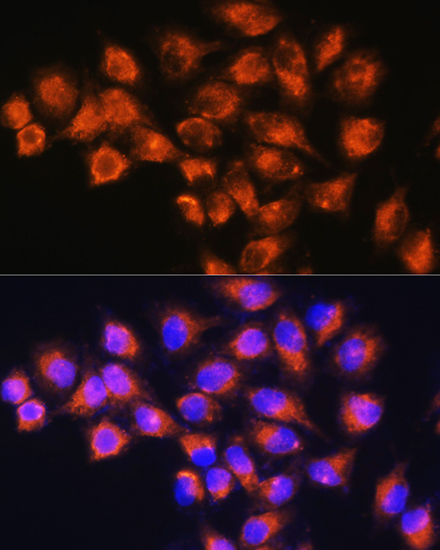 NPB Polyclonal Antibody
