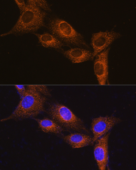 NPB Polyclonal Antibody