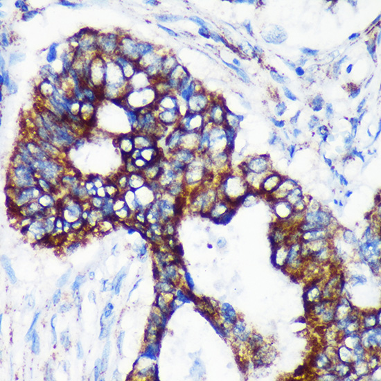 CHCHD2 Polyclonal Antibody
