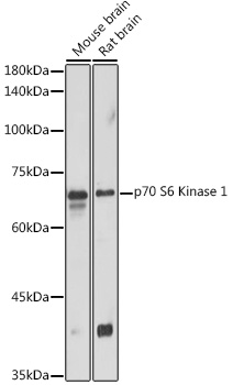 P70 S6K Polyclonal Antibody