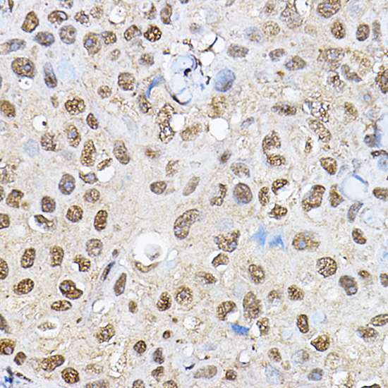 P70 S6K Polyclonal Antibody