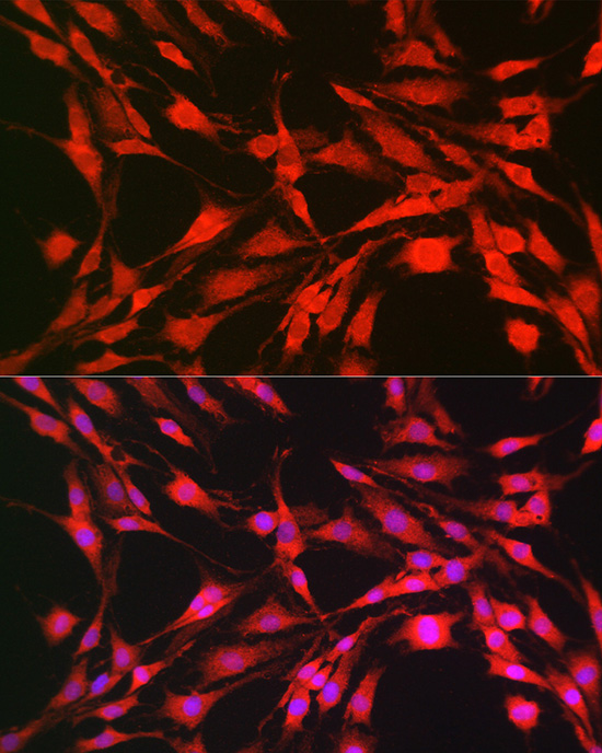 P70 S6K Polyclonal Antibody