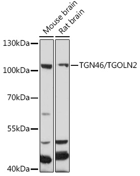 TGOLN2 Polyclonal Antibody