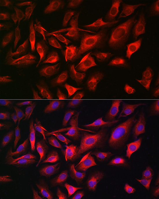 TGOLN2 Polyclonal Antibody