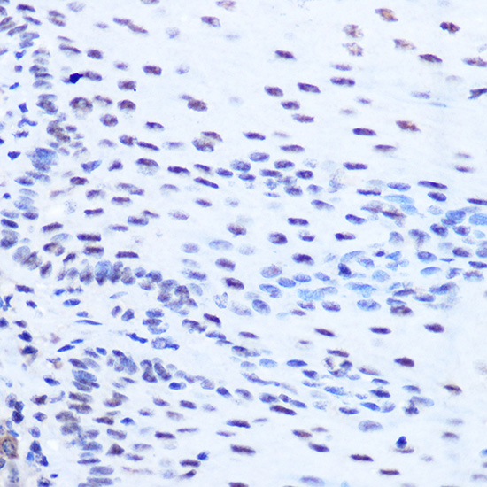 SRSF7 Polyclonal Antibody