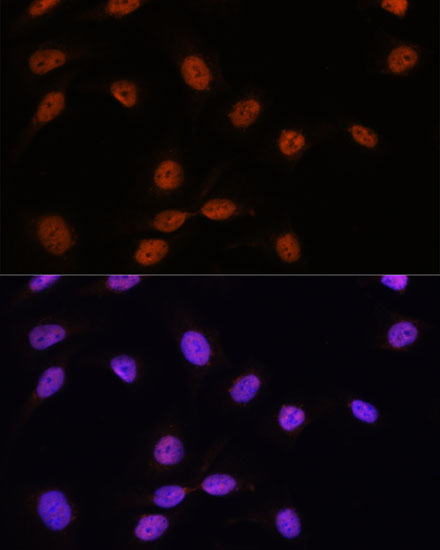 SRSF7 Polyclonal Antibody