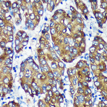 NSDHL Polyclonal Antibody
