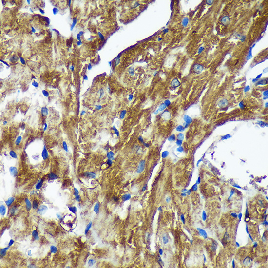 NSDHL Polyclonal Antibody