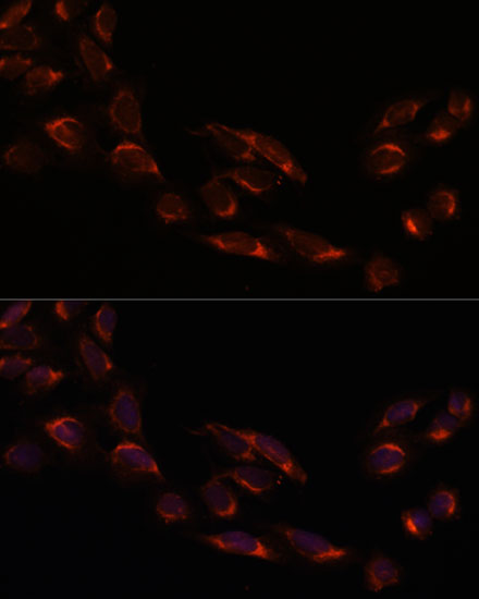 NSDHL Polyclonal Antibody