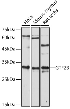 GTF2B Polyclonal Antibody