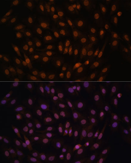 FCF1 Polyclonal Antibody