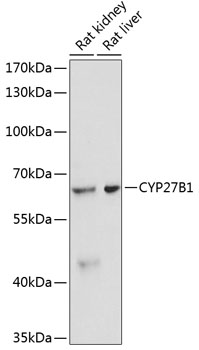 CYP27B1 Polyclonal Antibody