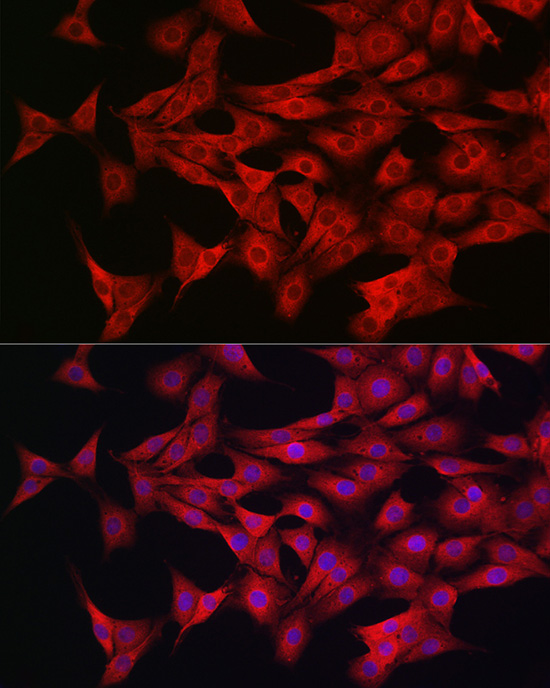 PRKAA1/PRKAA2 Polyclonal Antibody