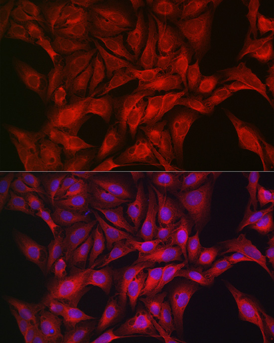 PRKAA1/PRKAA2 Polyclonal Antibody