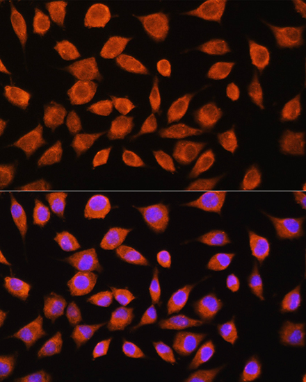 MOBP Polyclonal Antibody