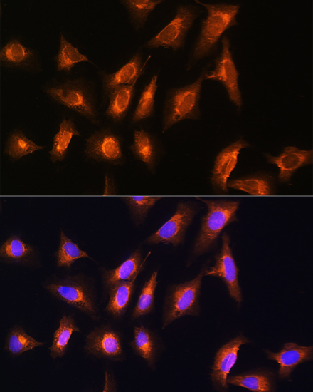 MOBP Polyclonal Antibody