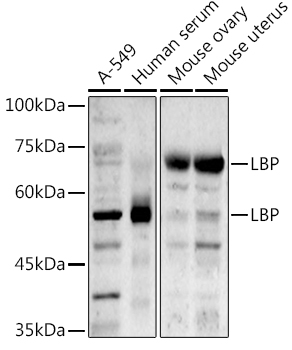 LBP Polyclonal Antibody