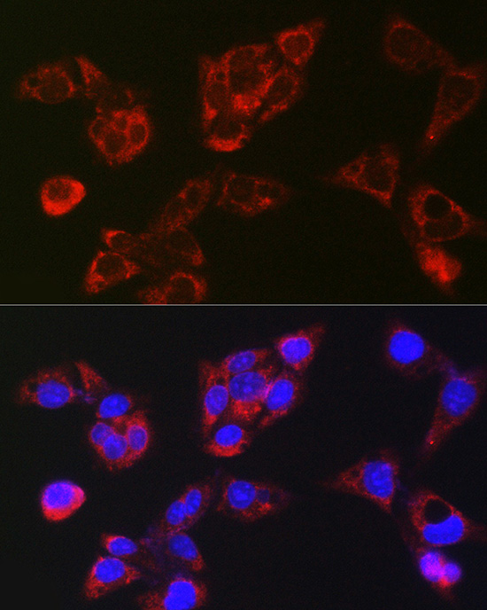 LBP Polyclonal Antibody