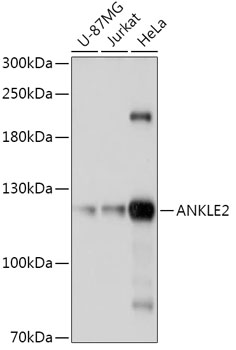 ANKLE2 Polyclonal Antibody