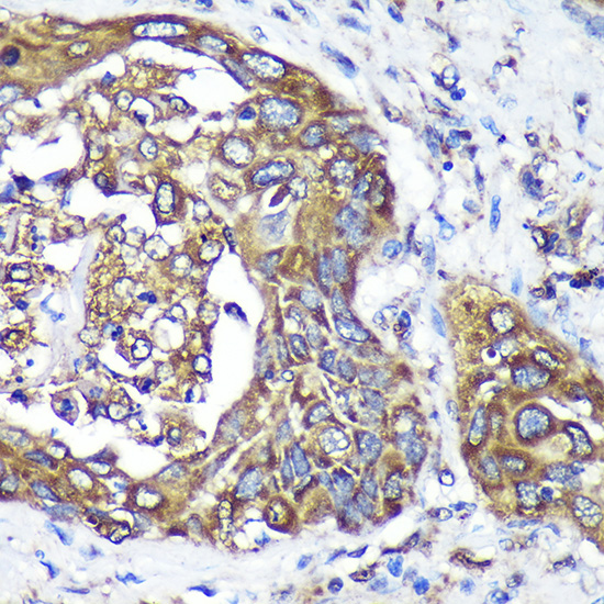 ANKLE2 Polyclonal Antibody